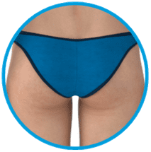 EMSculpt Buttocks Treatment Area