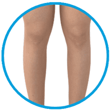 EMSculpt Calves Treatment Area