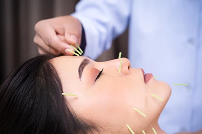 Acupuncture Expert Edmonds WA
